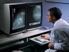 Marketing Campaign for Digital Mammography